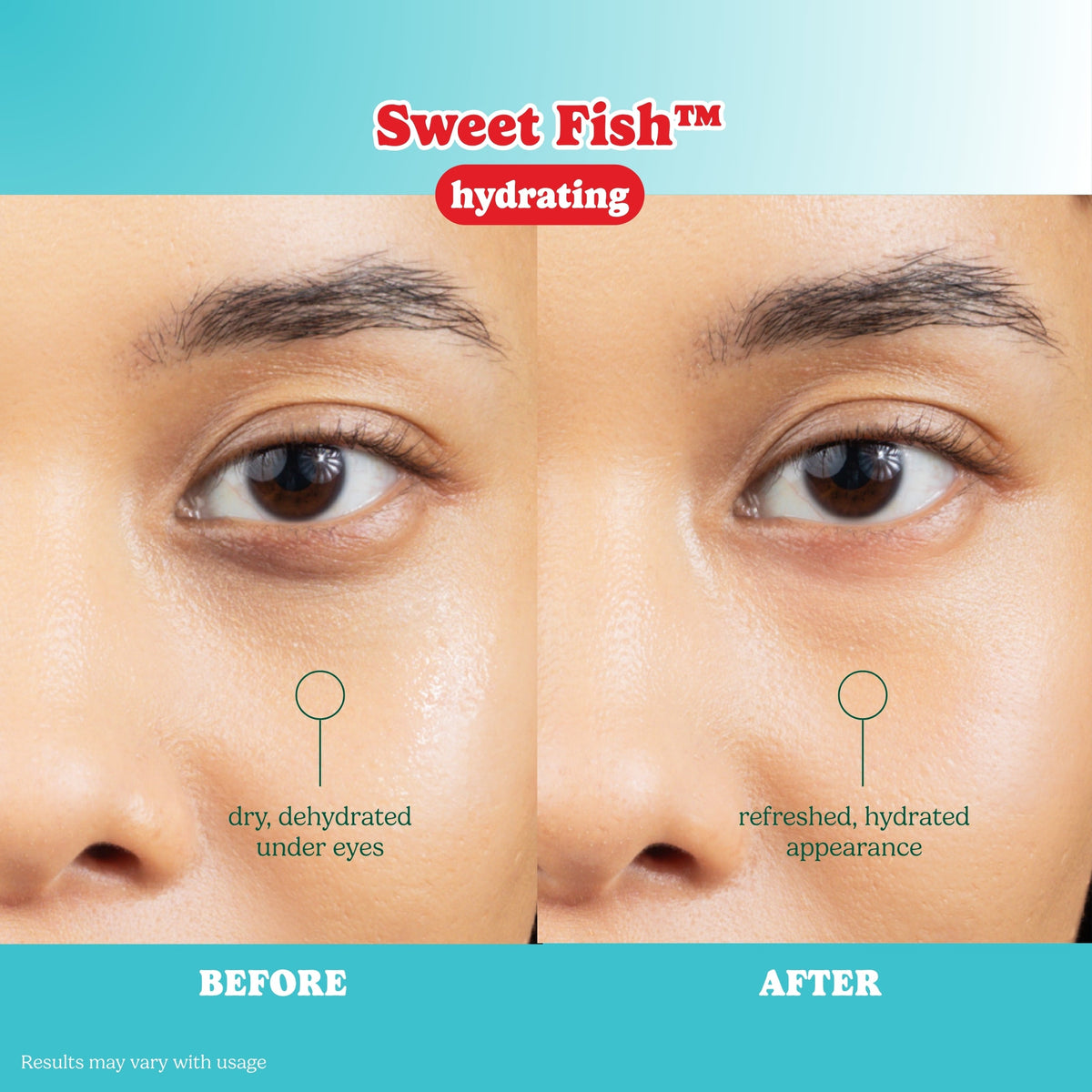 ESW Beauty x SmartSweets Eye Patches