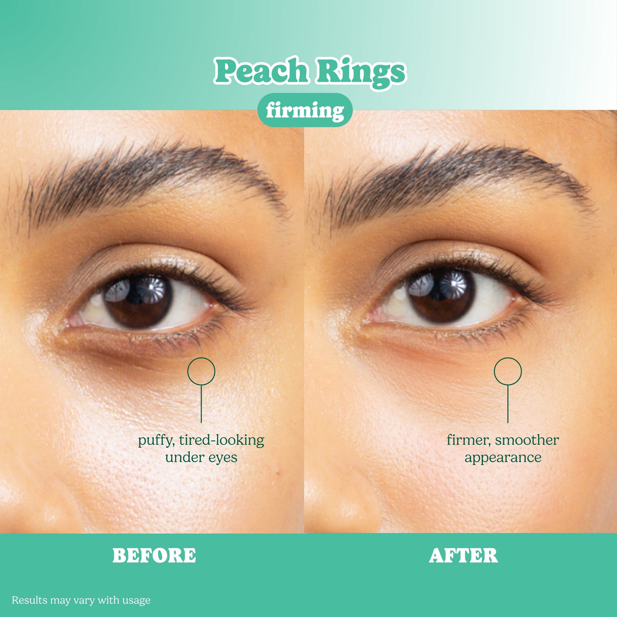 ESW Beauty x SmartSweets Eye Patches