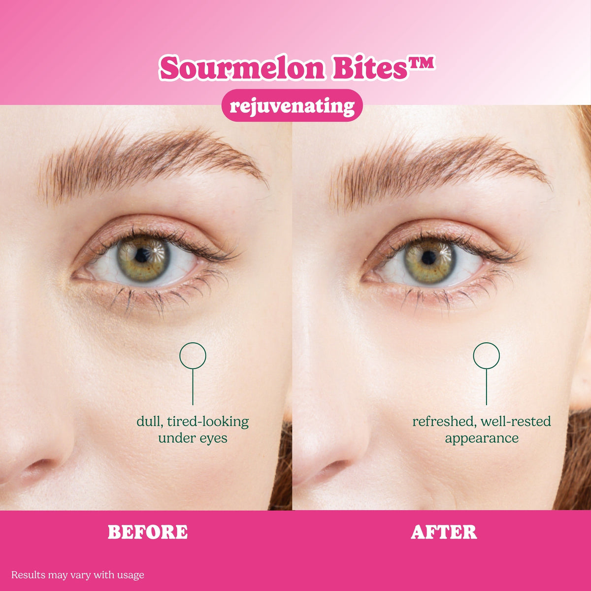 ESW Beauty x SmartSweets Eye Patches