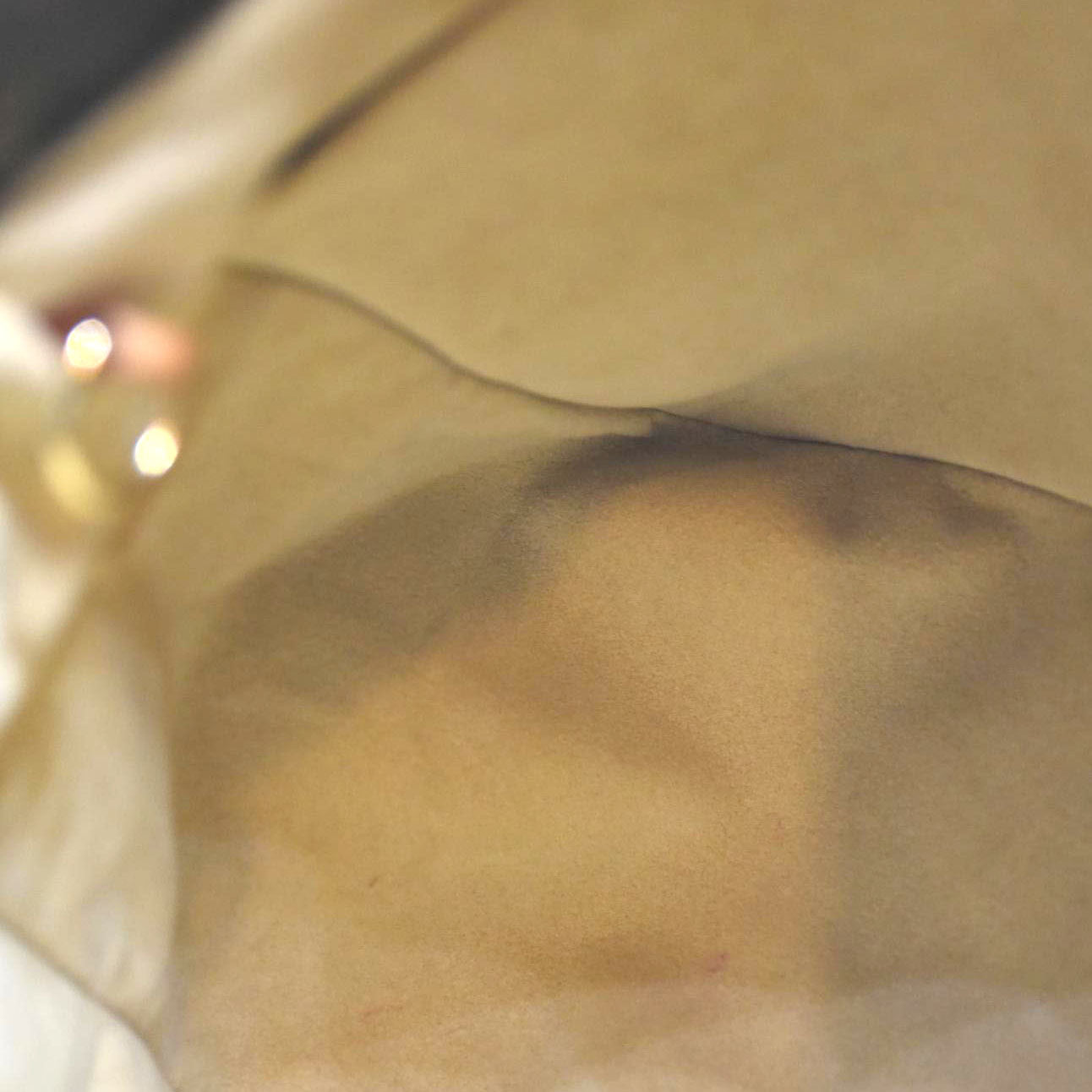 Louis Vuitton  Monogram Artsy MM CA1150